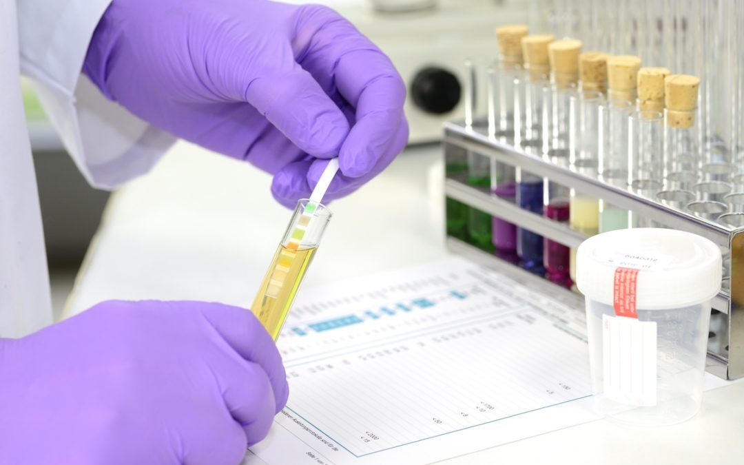 How Drug Testing Changes Affect Employers and the Healthcare Industry