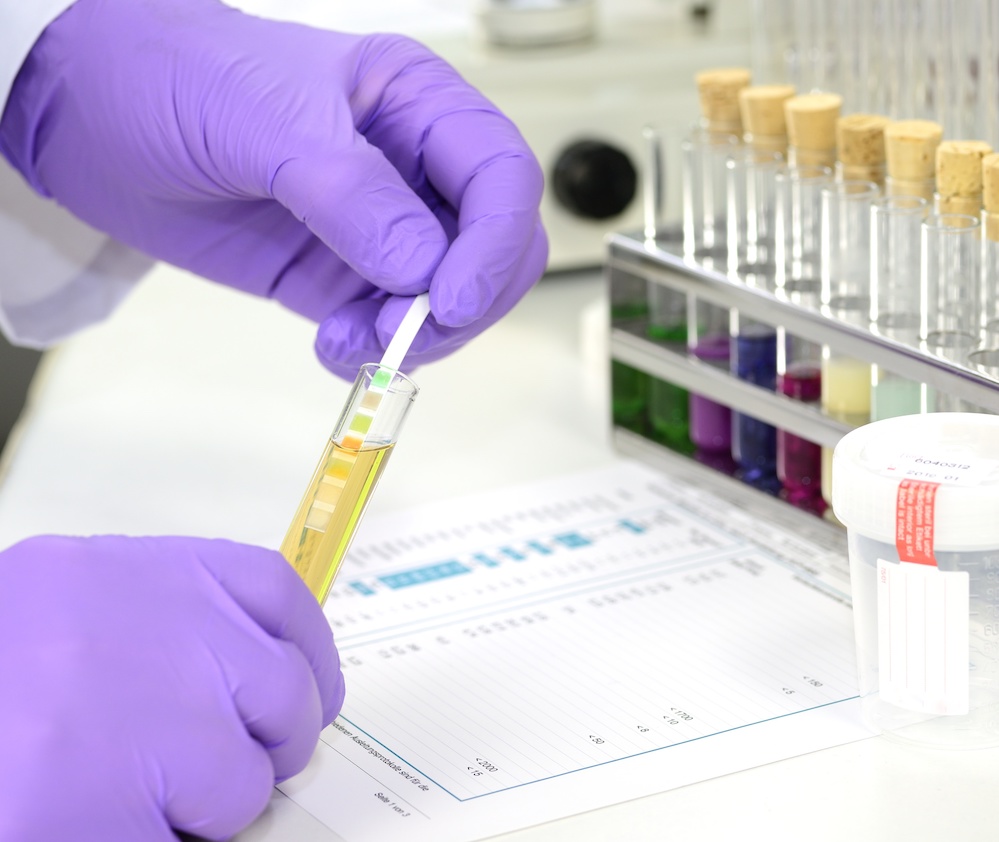 Urine Drug Testing Genesis Reference Labs