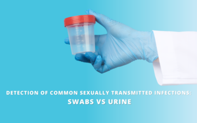 Detection of Common Sexually Transmitted Infections: Swabs vs Urine